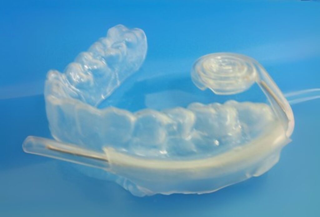 唾液吸引マウスピースの商品写真。嚥下や口腔ケアをサポートするための医療補助具。安全で衛生的なデザインを表す。